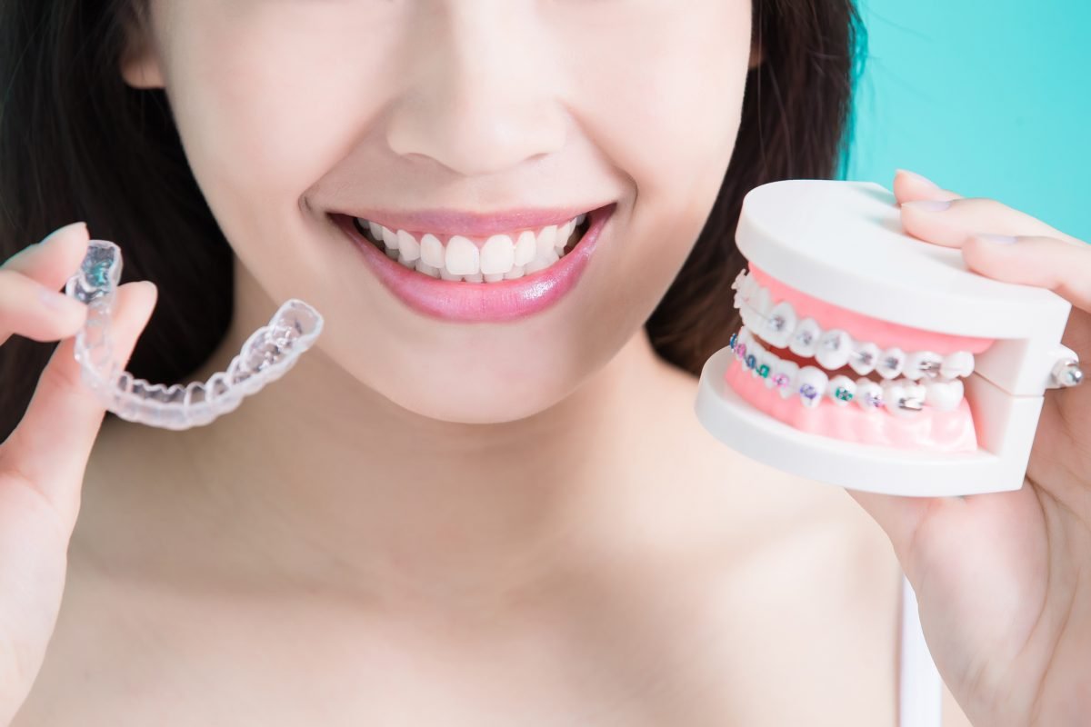 The Day the Braces Come Off, and What Your Dentist Checks Next
